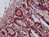 SHPRH Antibody - Immunohistochemistry image at a dilution of 1:400 and staining in paraffin-embedded human small intestine tissue performed on a Leica BondTM system. After dewaxing and hydration, antigen retrieval was mediated by high pressure in a citrate buffer (pH 6.0) . Section was blocked with 10% normal goat serum 30min at RT. Then primary antibody (1% BSA) was incubated at 4 °C overnight. The primary is detected by a biotinylated secondary antibody and visualized using an HRP conjugated SP system.