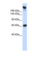 SI / Sucrase Isomaltase Antibody - SI / Alpha-Glucosidase antibody Western blot of Fetal Muscle lysate. This image was taken for the unconjugated form of this product. Other forms have not been tested.