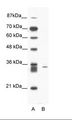 SIAH1 Antibody - A: Marker, B: Jurkat Cell Lysate.  This image was taken for the unconjugated form of this product. Other forms have not been tested.