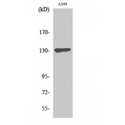 SIN3B Antibody - Western blot of Sin3B antibody