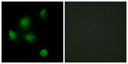 SIN3B Antibody - Immunofluorescence analysis of HeLa cells, using SIN3B Antibody. The picture on the right is blocked with the synthesized peptide.
