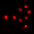 SIN3B Antibody - Immunofluorescent analysis of SIN3B staining in HCT116 cells. Formalin-fixed cells were permeabilized with 0.1% Triton X-100 in TBS for 5-10 minutes and blocked with 3% BSA-PBS for 30 minutes at room temperature. Cells were probed with the primary antibody in 3% BSA-PBS and incubated overnight at 4 C in a humidified chamber. Cells were washed with PBST and incubated with a DyLight 594-conjugated secondary antibody (red) in PBS at room temperature in the dark. DAPI was used to stain the cell nuclei (blue).