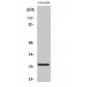SIP / TP53INP1 Antibody - Western blot of TP53INP1 antibody