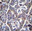 SIP / TP53INP1 Antibody - TP53INP1 Antibody immunohistochemistry of formalin-fixed and paraffin-embedded human pancreas tissue followed by peroxidase-conjugated secondary antibody and DAB staining.