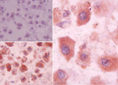 SIPR3 / EDG3 / S1P3 Antibody - IHC of Sphingolipid Receptor Edg3/S1P3 in formalin-fixed, paraffin-embedded human liver tissue using an isotype control (top left) and Polyclonal Antibody to Sphingolipid Receptor Edg3/S1P3 (bottom left, right) at 5 ug/ml.
