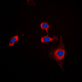SIRPA / CD172a Antibody - Immunofluorescent analysis of CD172a staining in THP1 cells. Formalin-fixed cells were permeabilized with 0.1% Triton X-100 in TBS for 5-10 minutes and blocked with 3% BSA-PBS for 30 minutes at room temperature. Cells were probed with the primary antibody in 3% BSA-PBS and incubated overnight at 4 C in a humidified chamber. Cells were washed with PBST and incubated with a DyLight 594-conjugated secondary antibody (red) in PBS at room temperature in the dark. DAPI was used to stain the cell nuclei (blue).