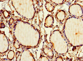 SIRPB1 / CD172b Antibody - Immunohistochemistry of paraffin-embedded human thyroid tissue at dilution 1:100