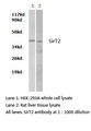 SIRT2 / Sirtuin 2 Antibody - Western blot of SirT2 pAb in extracts from HEK-293A cells and rat liver tissues.