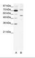 SIRT3 / Sirtuin 3 Antibody - A: Marker, B: HepG2 Cell Lysate.  This image was taken for the unconjugated form of this product. Other forms have not been tested.