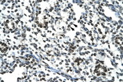 SIRT5 / Sirtuin 5 Antibody - SIRT5 antibody ARP32391_T100-NP_112534-SIRT5 (sirtuin (silent mating type information regulation 2 homolog) 5 (S. cerevisiae)) Antibody IHC of formalin-fixed, paraffin-embedded human Lung. Positive label: Alveolar cells indicated with arrows. Antibody concentration 4-8 ug/ml. Magnification 400X.  This image was taken for the unconjugated form of this product. Other forms have not been tested.