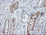 SIRT5 / Sirtuin 5 Antibody - IHC of paraffin-embedded Human Kidney tissue using anti-SIRT5 mouse monoclonal antibody.