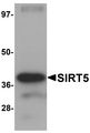 SIRT5 / Sirtuin 5 Antibody - Western blot analysis of SIRT5 in human liver tissue lysate with SIRT5 antibody at 1 ug/ml.