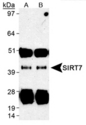 SIRT7 / Sirtuin 7 Antibody - SIRT7 Immunoprecipitated from human liver lysates with SIRT7 Antibody. A). SIRT7 Antibody LS-C141851 B). SIRT7 Antibody LS-C141850.  This image was taken for the unconjugated form of this product. Other forms have not been tested.