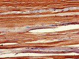 SIX1 Antibody - Immunohistochemistry of paraffin-embedded human skeletal muscle tissue using SIX1 Antibody at dilution of 1:100