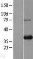 SIX1 Protein - Western validation with an anti-DDK antibody * L: Control HEK293 lysate R: Over-expression lysate