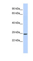 SIX2 Antibody - SIX2 antibody Western blot of Fetal Muscle lysate. This image was taken for the unconjugated form of this product. Other forms have not been tested.