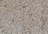 SIX3 Antibody - 1:100 staining mouse kidney tissue by IHC-P. The sample was formaldehyde fixed and a heat mediated antigen retrieval step in citrate buffer was performed. The sample was then blocked and incubated with the antibody for 1.5 hours at 22°C. An HRP conjugated goat anti-rabbit antibody was used as the secondary.