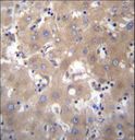 SIX5 Antibody - SIX5 Antibody immunohistochemistry of formalin-fixed and paraffin-embedded human liver tissue followed by peroxidase-conjugated secondary antibody and DAB staining.