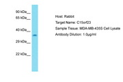 SKAP / HSD11 Antibody -  This image was taken for the unconjugated form of this product. Other forms have not been tested.