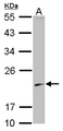 SKP1 Antibody - Sample (30 ug of whole cell lysate) A: 293T 12% SDS PAGE SKP1 antibody diluted at 1:1000