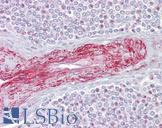 SLA Antibody - Anti-SLA antibody IHC of human spleen. Immunohistochemistry of formalin-fixed, paraffin-embedded tissue after heat-induced antigen retrieval. Antibody concentration 5 ug/ml.  This image was taken for the unconjugated form of this product. Other forms have not been tested.