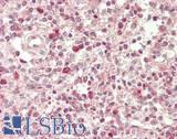 SLAMF1 / SLAM / CD150 Antibody - Human Spleen: Formalin-Fixed, Paraffin-Embedded (FFPE)