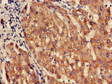 SLC10A3 Antibody - Immunohistochemistry of paraffin-embedded human liver tissue using SLC10A3 Antibody at dilution of 1:100