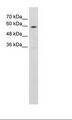 SLC11A1 / NRAMP Antibody - HepG2 Cell Lysate.  This image was taken for the unconjugated form of this product. Other forms have not been tested.