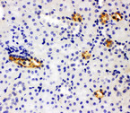 SLC12A1 / NKCC2 Antibody - SLC12A1 / NKCC2 antibody. IHC(P): Rat Kidney Tissue.