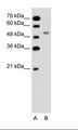 SLC12A1 / NKCC2 Antibody - A: Marker, B: Jurkat Cell Lysate.  This image was taken for the unconjugated form of this product. Other forms have not been tested.