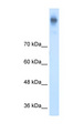 SLC12A2 / NKCC1 Antibody - SLC12A2 / NKCC1 antibody ARP43805_T100-NP_001037-SLC12A2(solute carrier family 12 (sodium/potassium/chloride transporters), member 2) Antibody Western blot of DLD1 cell lysate.  This image was taken for the unconjugated form of this product. Other forms have not been tested.
