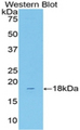 SLC12A3 / TSC Antibody - Western blot of recombinant SLC12A3 / TSC.  This image was taken for the unconjugated form of this product. Other forms have not been tested.