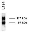 SLC14A2 / UTR Antibody - Western blot analysis of UT-A1 in rat inner medulla using a 1:1000 dilution of SLC14A2 / UTR antibody.  This image was taken for the unconjugated form of this product. Other forms have not been tested.