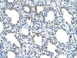 SLC15A4 / PHT1 Antibody - SLC15A4 antibody SLC15A4(solute carrier family 15, member 4) Antibody was used in IHC to stain formalin-fixed, paraffin-embedded human lung.  This image was taken for the unconjugated form of this product. Other forms have not been tested.