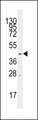 SLC16A1 / MCT1 Antibody - Western blot of anti-SLC16A1 Antibody in CEM cell line lysates (35 ug/lane). SLC16A1 (arrow) was detected using the purified antibody.
