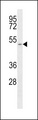 SLC16A1 / MCT1 Antibody - Western blot of anti-SLC16A1 Antibody in T47D cell line lysates (35 ug/lane). SLC16A1(arrow) was detected using the purified antibody.