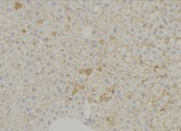 SLC16A11 Antibody - 1:100 staining mouse liver tissue by IHC-P. The sample was formaldehyde fixed and a heat mediated antigen retrieval step in citrate buffer was performed. The sample was then blocked and incubated with the antibody for 1.5 hours at 22°C. An HRP conjugated goat anti-rabbit antibody was used as the secondary.