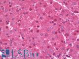 SLC16A14 / MCT14 Antibody - Human Liver: Formalin-Fixed, Paraffin-Embedded (FFPE)