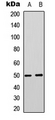 SLC16A3 Antibody - Western blot analysis of MCT4 expression in Jurkat (A); PC3 (B) whole cell lysates.