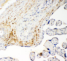 SLC16A4 Antibody - SLC16A4 / MCT4 antibody. IHC(P): Human Placenta Cancer Tissue.