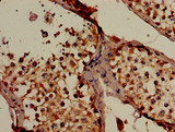 SLC16A7 / MCT2 Antibody - Immunohistochemistry of paraffin-embedded human testis tissue using SLC16A7 Antibody at dilution of 1:100