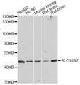 SLC16A7 / MCT2 Antibody - Western blot analysis of extracts of various cell lines, using SLC16A7 antibody at 1:3000 dilution. The secondary antibody used was an HRP Goat Anti-Rabbit IgG (H+L) at 1:10000 dilution. Lysates were loaded 25ug per lane and 3% nonfat dry milk in TBST was used for blocking. An ECL Kit was used for detection and the exposure time was 90s.