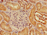 SLC16A9 Antibody - Immunohistochemistry of paraffin-embedded human kidney tissue using SLC16A9 Antibody at dilution of 1:100