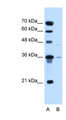 SLC17A3 Antibody - SLC17A3 antibody ARP42305_P050-NP_006623-SLC17A3(solute carrier family 17 (sodium phosphate), member 3) Antibody Western blot of HepG2 cell lysate.  This image was taken for the unconjugated form of this product. Other forms have not been tested.