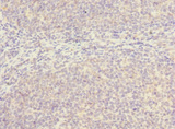 SLC17A3 Antibody - Immunohistochemistry of paraffin-embedded human tonsil tissue using SLC17A3 Antibody at dilution of 1:100