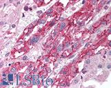 SLC18A1 / VMAT1 Antibody - Anti-SLC18A1 / VMAT1 antibody IHC of human adrenal. Immunohistochemistry of formalin-fixed, paraffin-embedded tissue after heat-induced antigen retrieval. Antibody concentration 5 ug/ml.  This image was taken for the unconjugated form of this product. Other forms have not been tested.