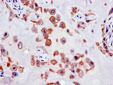 SLC18A1 / VMAT1 Antibody - Immunohistochemistry of paraffin-embedded human placenta tissue using SLC18A1 Antibody at dilution of 1:100