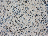SLC18A2 / VMAT2 Antibody - IHC of paraffin-embedded Ovary tissue using anti-SLC18A2 mouse monoclonal antibody. (Dilution 1:50).