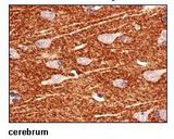 SLC1A2 / EAAT2 / GLT-1 Antibody - Formalin-fixed, paraffin-embedded human cerebrum.