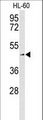 SLC1A5 / ASCT2 Antibody - Western blot of SLC1A5 Antibody in K562 cell line lysates (35 ug/lane). SLC1A5 (arrow) was detected using the purified antibody.